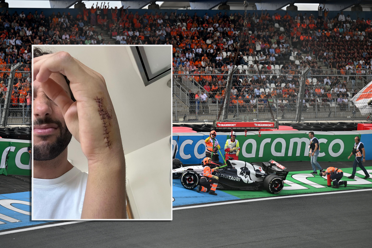 Ricciardo deelt foto van geopereerde hand na opgelopen botbreuk in Zandvoort