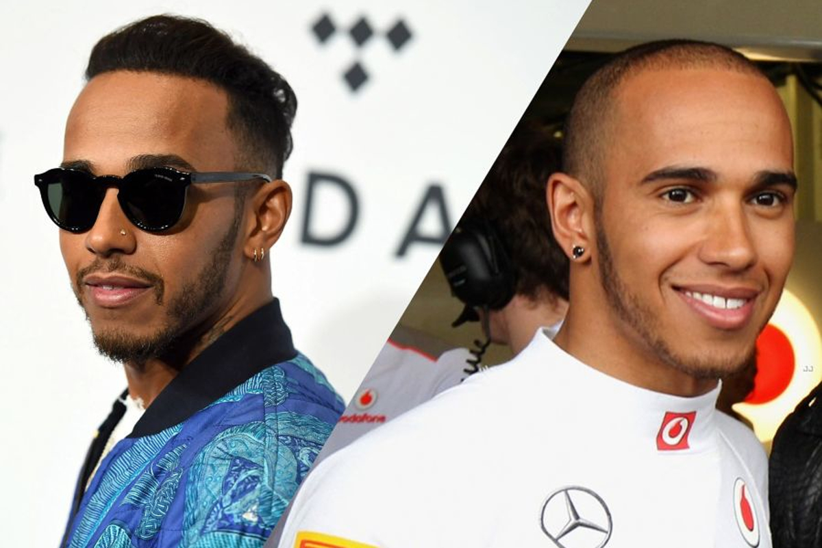 Heeft Lewis Hamilton een haartransplantatie ondergaan?