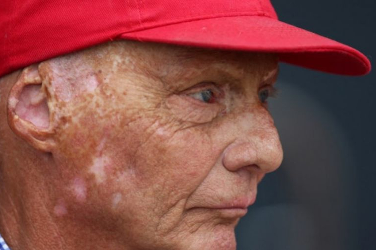 Lauda 'wakens from coma' after lung transplant