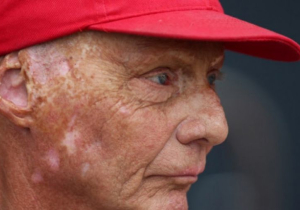 Lauda: 'Je bent gek als je elk weekend een andere winnaar wil'