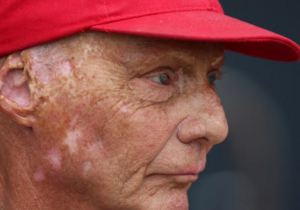 Lauda: Mercedes will have to work hard now