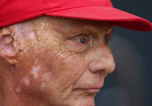 Niki Lauda: "Ga weg met die 'under investigation'-meldingen"