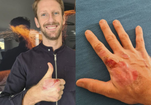 Grosjean mag eerste hand uit het verband halen: "Links moet nog herstellen"