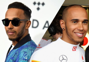 Heeft Lewis Hamilton een haartransplantatie ondergaan?