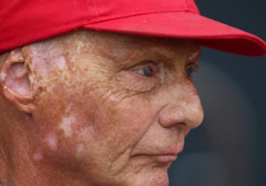 Lauda 'wakens from coma' after lung transplant