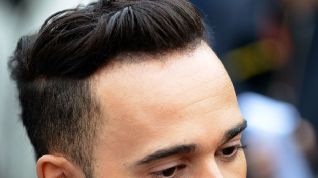 Heeft Lewis Hamilton een haartransplantatie ondergaan ...