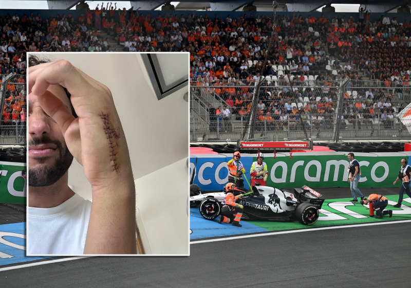Ricciardo gives NEW update on hand injury as BIG F1 rival lends support
